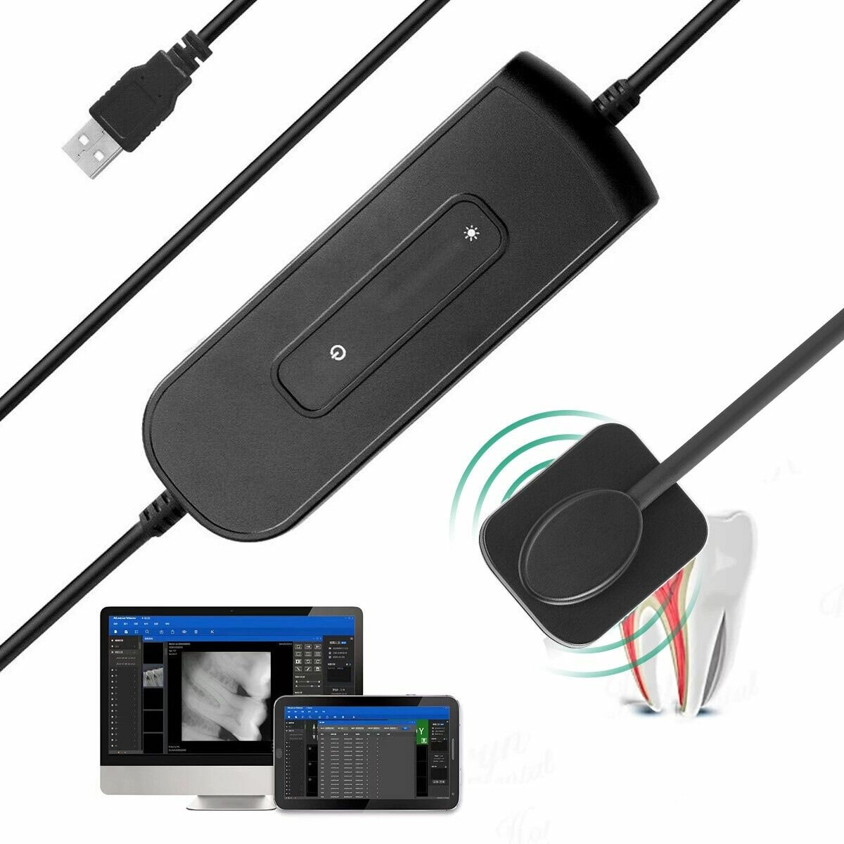 Визиограф Any sensor 1.0 TO221